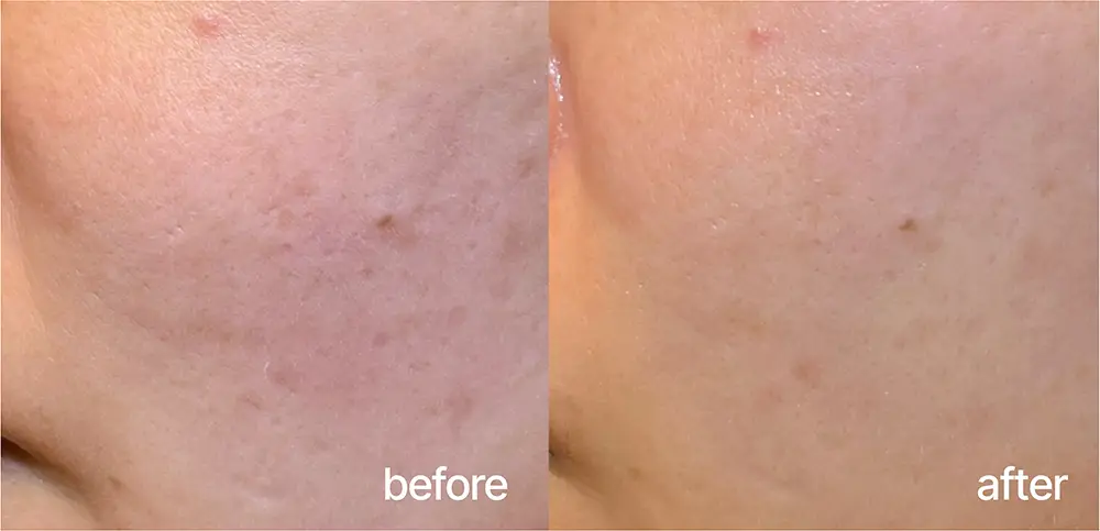 9196987e-e647-48dc-bf6e-9b3f2d281798